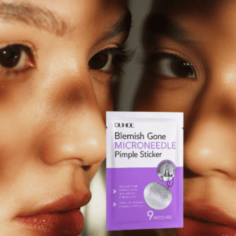 Microneedle Pimple Sticker  Kill Deep Cystic Pimples Overnight — Before They Explode